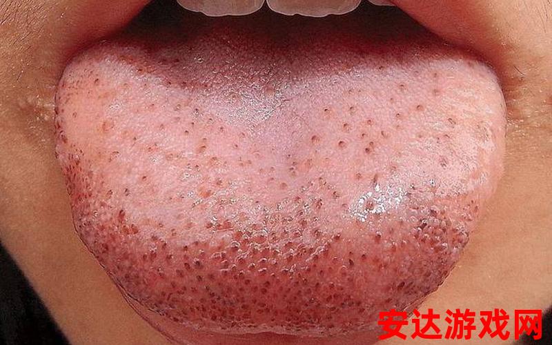 伸出舌头往一边歪什么病：舌头往一边歪是什么病？
