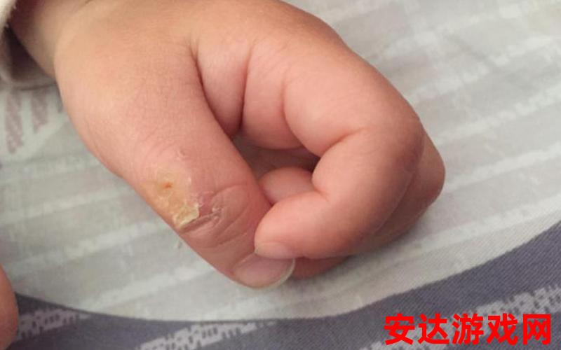 婴儿多根手指：婴儿多根手指，是一种罕见的现象吗？